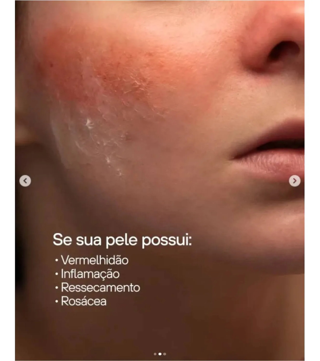 Kit Facial Pele Sensível Dermo Skin c/ 3 Itens Labotrat 3