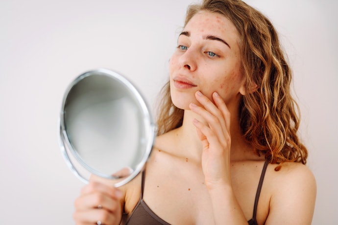 Se Você Tem Pele Sensível, Opte por Séruns Antiacne com LHA