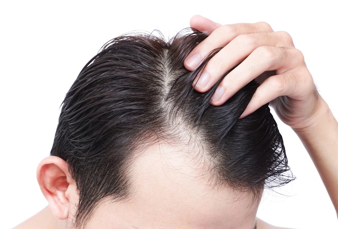 Sofre Com Queda ? Shampoo Fortificante e Antiqueda Podem Ajudar em Alguns Casos