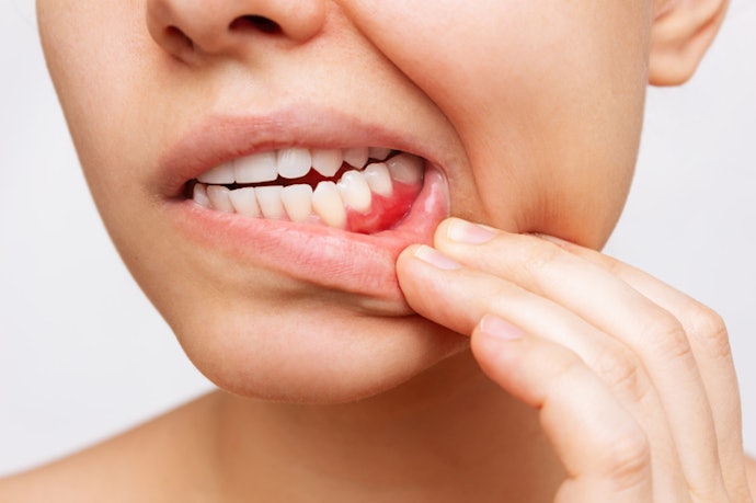 Sua Gengiva Também É Sensível? Escolha Creme Dental para Sensibilidade com Ação Dupla