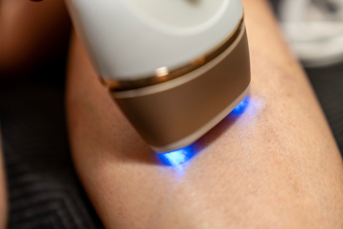 Quer Mais Precisão? Prefira Depiladores a Luz Pulsada com pelo Menos 3 Níveis de Intensidade