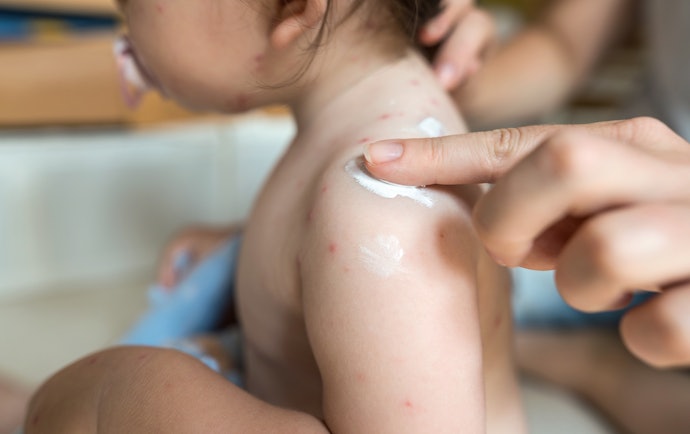 Repelentes em Gel são Absorvidos Mais Rapidamente e os Spray são Mais Fáceis de Aplicar