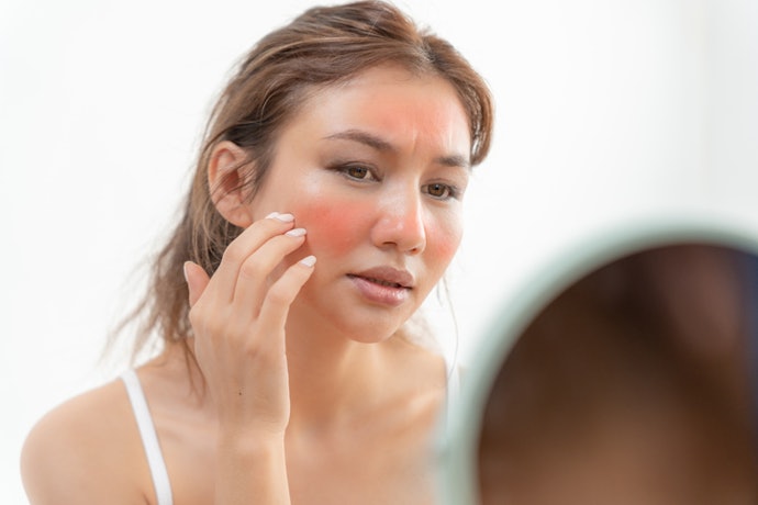Para Evitar Irritações e Alergias, Escolha Cremes Hipoalergênicos e Dermatologicamente Testados