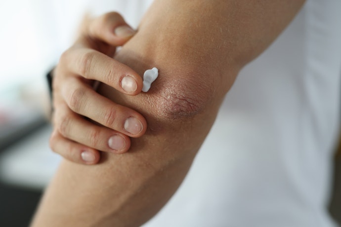Para Pele Seca e Extrasseca, Escolha Um Creme Corporal Feminino com Ureia ou Glicerina