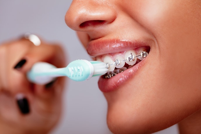 Busca a Melhor Escova de Dente para Quem Usa Aparelho? Considere as com Cerdas Irregulares