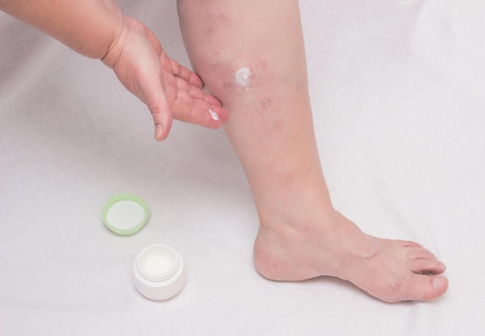 Se Busca um Creme Anti-Inflamatório para Lipedema, Invista em Opções com Camomila e Niacinamida