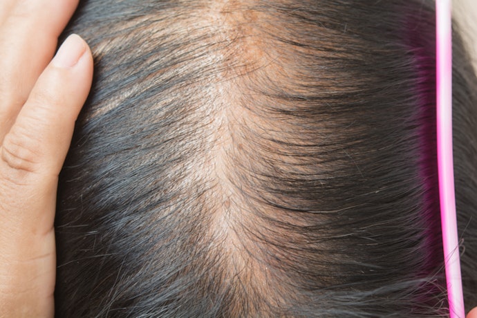 Para Couro Cabeludo Sensível, Prefira Shampoo com Alantoína