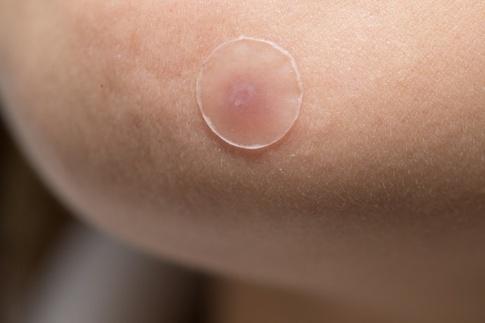Para Homens e Peles Mais Claras ou Mais Escuras, Prefira Adesivo para Espinha Transparente