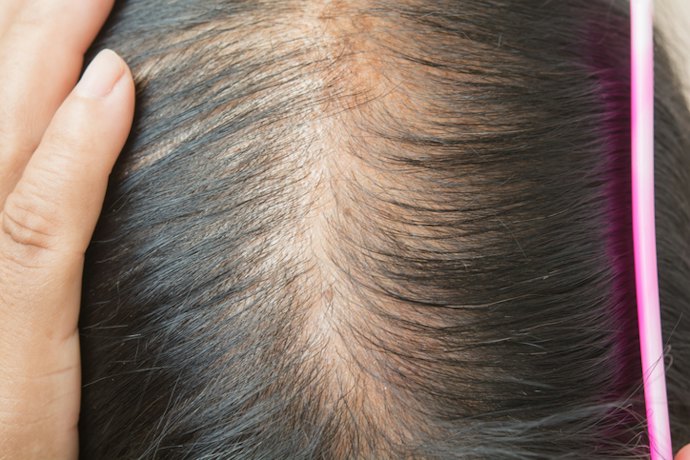 Para Couro Cabeludo Sensível, Prefira Shampoo com Alantoína