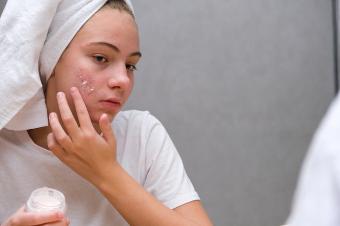 Se Sua Cicatriz é Atrófica, Prefira Pomada com Retinoides