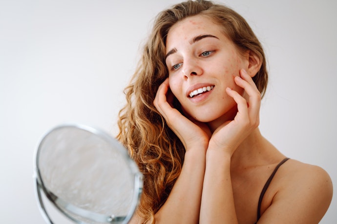 Para Auxiliar no Controle da Acne, Busque Loções Hidratantes com Niacinamida