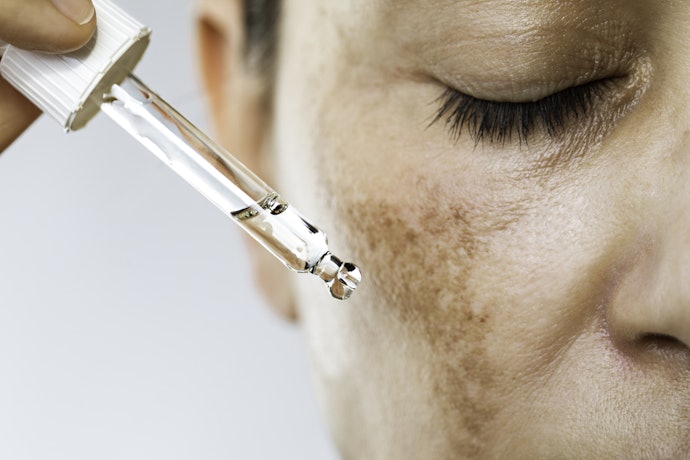 Para Suavizar Manchas de Melasma, Busque Peelings Enzimáticos Como o Abóbora, Romã e Mamão