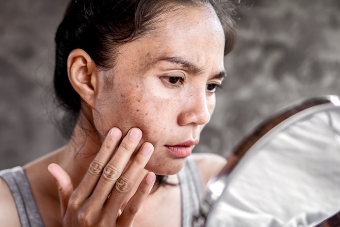 Tem Manchas ou Melasma? Prefira Protetor Solar Facial Clareador com Niacinamida e Alfa-Arbutin